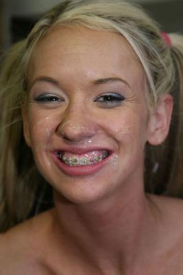 Brace Face Facial - cum dripping braces