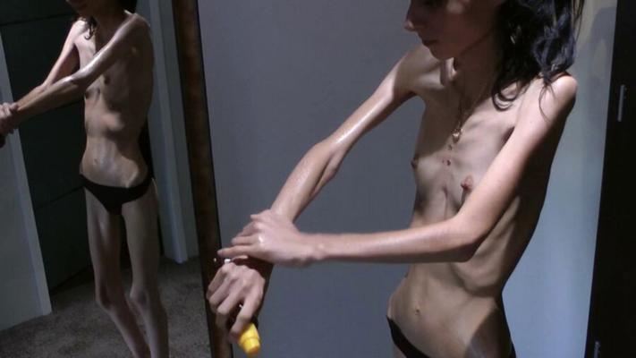 Nicoleta - anorexic skinny fragile mager duenn knochig bones