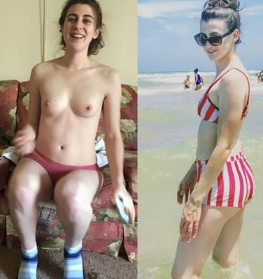 Antes y después (tetas pequeñas)