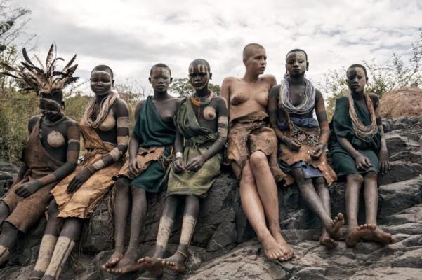 Menina branca e careca na África