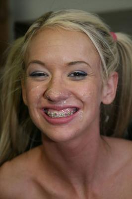 Sluts With Braces Get Cum To Faces: Orthodontic Sperm Whores