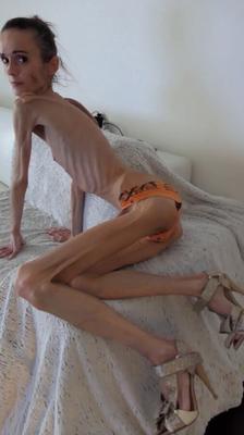 Denisa - maigre anorexique fragile mager duenn knochig