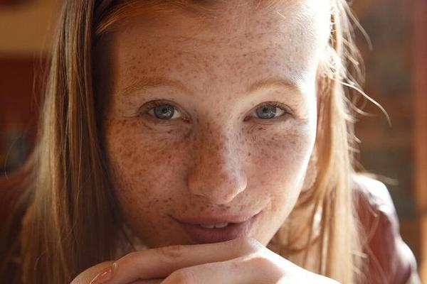 Redhead freckled teen