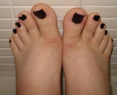 uñas de los pies negras