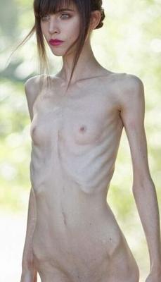 Anorexic Model, Wilkomira